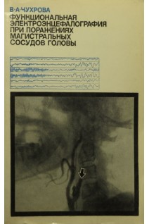 Функциональная электроэнцефалография при поражениях магистральных сосудов головы (БУ). Чухрова В.А.