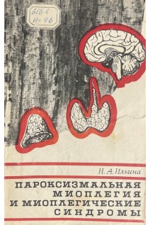 Пароксизмальная миоплегия и миоплегические синдромы (БУ). Ильина Н.