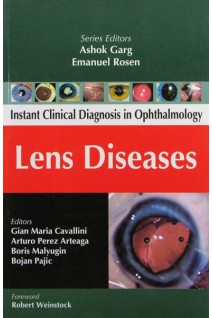 Lens Diseases (Instant Clinical Diagnosis in Ophthalmology). Cavallini