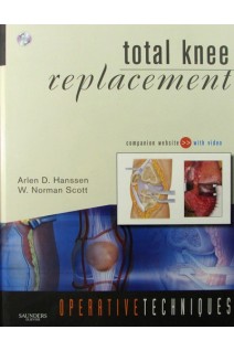 Operative Techniques: Total Knee Replacement. Arlen D. Hanssen and W. Norman Scott MD
