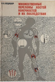 Множественные переломы костей конечностей и их последствия (БУ). Бецишор В.К.