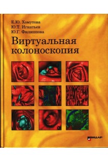 Виртуальная колоноскопия. Хомутова Е.Ю. Игнатьев Ю.Т.