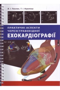 Практичні аспекти черезстравохідної ехокардіографії. Павлюк В.І. за ред. Жарінова О.Й.