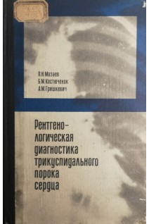Рентгенологическая диагностика трикуспидального порока сердца (БУ). Мазаев П.Н.