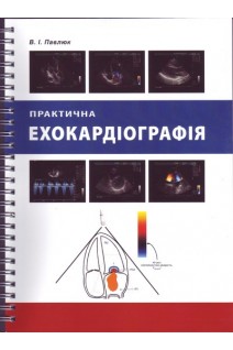 Практична ехокардіографія (пружина). Павлюк В.І. за ред. Жарінова О.Й.