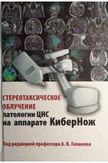 Стереотаксическое облучение патологии ЦНС на аппарате КиберНож.. Голанов А.В.