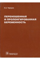 Переношенная и пролонгированная беременность. Чернуха Е.А.