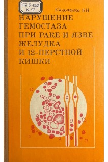 Нарушение гемостаза при раке и язве желудка и 12-перстной кишки (БУ). Кальченко Н.Н.