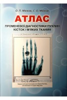 Атлас променевої діагностики пухлин кісток і мяких тканин (навчальний посібник). Мягков О.П. Мягков С.О.