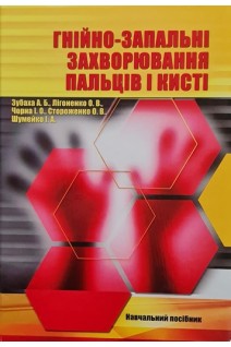 Гнійно-запальні захворювання пальців і кисті. Зубаха А.Б. Лігоненко О.В. Чорна І.О.