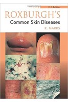 Roxburghs Common Skin Diseases 17Ed. Ronald Marks