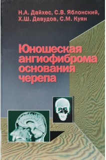 Юношеская ангиофиброма основания черепа. Дайхес Н.А.
