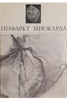 Инфаркт миокарда (БУ). Виноградов А.В.