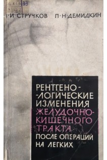 Рентгенологические изменения желудочно-кишечного тракта после операций на легких (БУ). Стручков И.