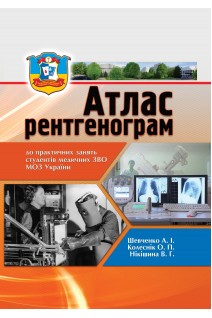 Атлас рентгенограм. Для практичних занять. Шевченко А.І. Колеснік О.П. Нікішина В.Г.