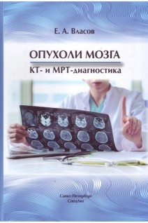 Опухоли мозга. КТ- и МРТ- диагностика. Власов Е.А.