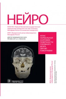 Атлас нормальной анатомии поверхности головного мозга при МР-томографии. Суфианов А.А.