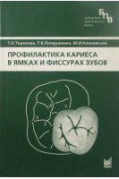 Профилактика кариеса в ямках и фиссурах зубов. Терехова