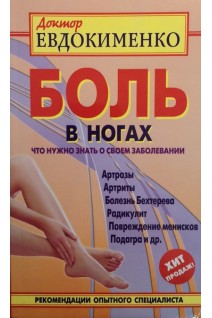 Боль в ногах. Что нужно знать о своем заболевании. Евдокименко П.В.