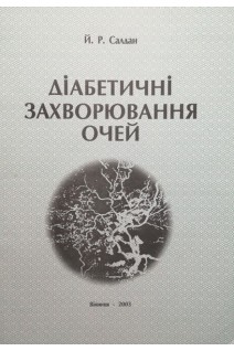 Діабетичні захворювання очей (БУ). Салдан Й.Р.