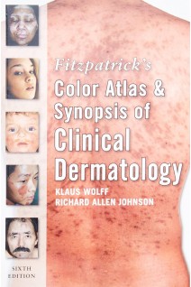 Fitzpatricks Color Atlas and Synopsis of Clinical Dermatology. Sixth Edition (БУ). Klaus Wolff Richard Johnson