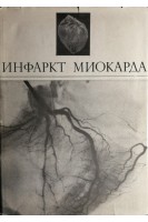 Инфаркт миокарда (БУ). Виноградов А.В.