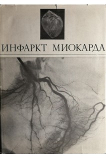 Инфаркт миокарда (БУ). Виноградов А.В.