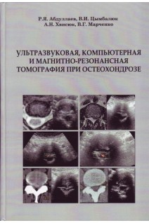 Ультразвуковая компьютерная и магнито-резонансная томография при остеохондрозе. Абдуллаев Р.Я. Цымбалюк В.И. Хвисюк А.Н. Марченко В.Г.