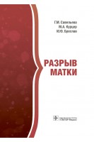 Разрыв матки. Г.М. Савельева М.А. Курцер И.Ю. Бреслав