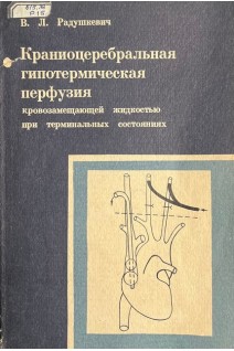 Краниоцеребральная гипотермическая перфузия кровозамещающей жидкостью при терминальных состояниях (БУ). Радушкевич В.Л.