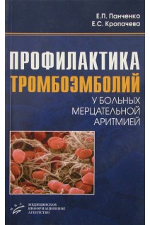 Профилактика тромбоэмболий у больных мерцательной аритмией. Панченко Е.П.