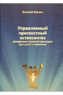 Управляемый чрескостный остеосинтез аппаратами внешней фиксации для детей и взрослых. Веклич В.В.