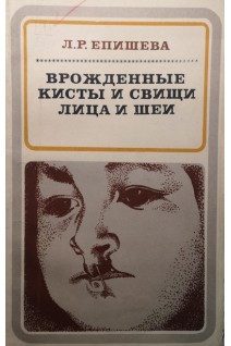 Врожденные кисты и свищи лица и шеи (БУ). Епишева Л.Р.