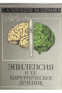 Эпилепсия и ее хирургическое лечение. Чхенкели С.А.