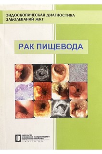 Рак пищевода. Эндоскопическая диагностика заболеваний ЖКТ: учебно-методическое пособие. Кузин М.Н. и др.