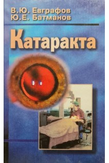 Катаракта. Евграфов В.Ю. Батманов Ю.Е.
