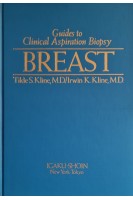 Guides to Clinical Aspiration Biopsy. Breast (БУ). Tilde S. Klin Irwin K. Kline