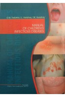 Manual of children's infectious diseases (Дитячі інфекційні хвороби). Fedortsiv O.Ye (Федорців О.Є.)