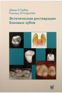 Эстетическая реставрация боковых зубов. Вкладки и накладки. Гарбер Д.А. Гольдштейн Р.Э.