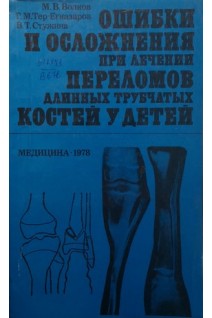 Ошибки и осложнения при лечении переломов длинных трубчастых костей у детей (БУ). Волков М.В.