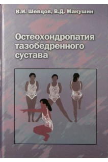Остеохондропатия тазобедренного сустава. Шевцов И.П. Дьячкова Г.В. Попков А.В.