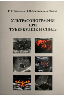 Ультрасонография при туберкулезе и СПИДе: учебное пособие. Абдуллаев Р.Я. Мытнык З.Н.