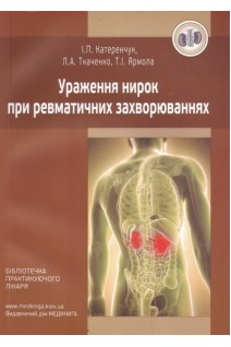 Ураження нирок при ревматичних захворюваннях. Навчальний посібник. Катеренчук І.П. Ткаченко Л.А. Ярмола Т.І.