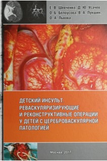 Детский инсульт. Реваскуляризирующие и реконструктивные операцииу детей с цереброваскулярной патологией. Шевченко Е.В. Усачев Д.Ю. Белоусова О.Б. Лукшин В.А. Львова О.А.