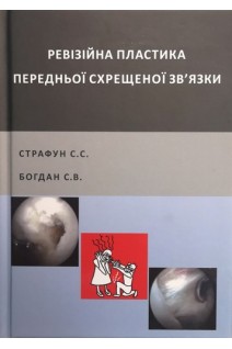 Ревізійна пластика передньої схрещеної звязки колінного суглоба. Страфун С.С. Богдан С.В.