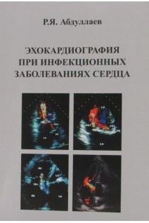 Эхокардиография при инфекционых заболеваниях сердца. Абдуллаев Р.Я. 