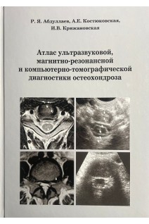 Атлас ультразвуковой магнитно-резонансной и компьютерно-томографической диагностики остеохондроза. Абдуллаев Р.Я. Костюковская А.Е. Крижановская И.В.
