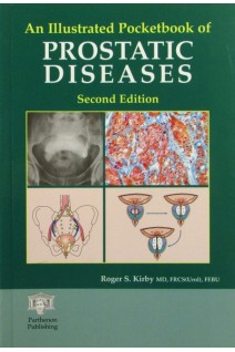 An Illustrated Pocketbook of Prostatic Diseases. Roger S. Kirby MD
