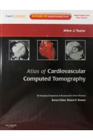 Atlas of Cardiovascular Computed Tomography. Allen J. Taylor MD