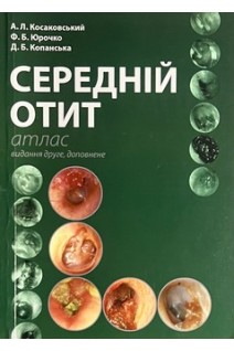 Середній отит. Атлас. Косаковський А.Л. Юрочко Ф.Б. Копанська Д.Б.